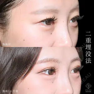 藤・ナチュレ美容クリニック 銀座院 小川 杏平医師の症例