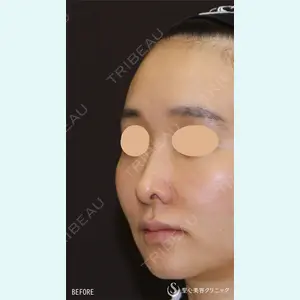 聖心美容クリニック 銀座院 牧野 陽二郎医師の症例