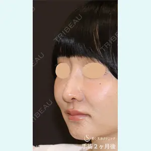 聖心美容クリニック 銀座院 牧野 陽二郎医師の症例