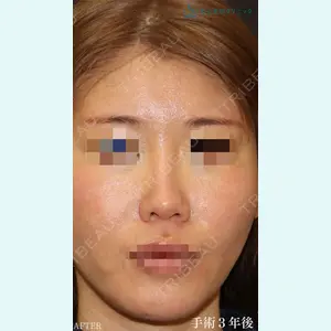 聖心美容クリニック 銀座院 牧野 陽二郎医師の症例