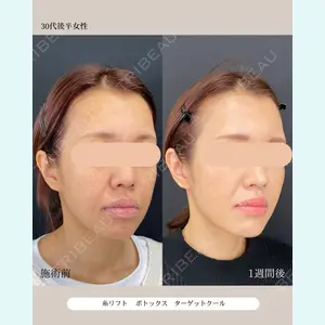 自由が丘ウェルエイジングビューティークリニック 福田 知佐子医師の症例