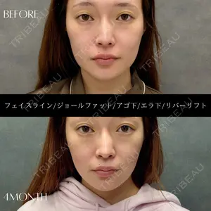 RIVER CLINIC（リバークリニック）大阪院 木家 佑理子医師の症例