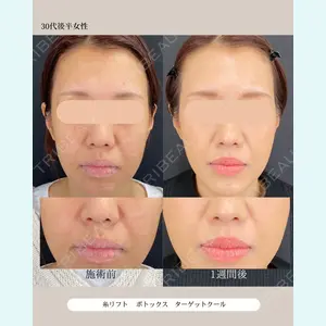 自由が丘ウェルエイジングビューティークリニック 福田 知佐子医師の症例