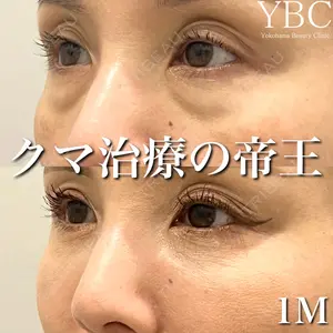 YBC横浜美容外科 大宮院 磯村 亮輔医師の症例