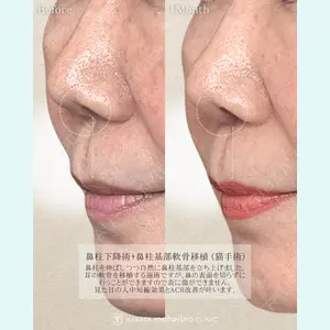 博多もへじのクリニック 村田 将光医師の症例