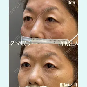 お茶の水美容形成クリニック 吉井 健吾医師の症例