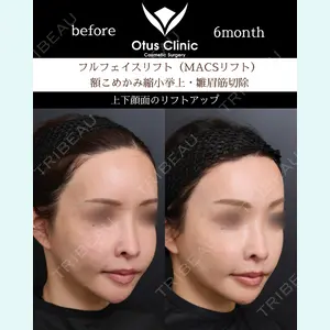 Otus Clinic 【オータスクリニック】 中 徳太郎医師の症例