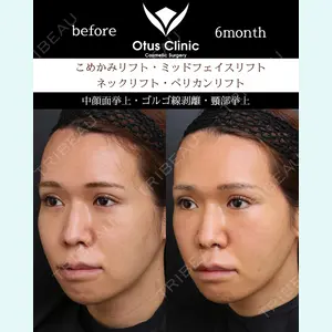 Otus Clinic 【オータスクリニック】 中 徳太郎医師の症例