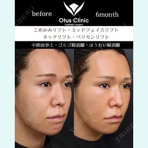 Otus Clinic 【オータスクリニック】 中 徳太郎医師の症例