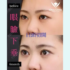 Otus Clinic 【オータスクリニック】 中 徳太郎医師の症例