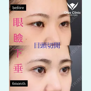 Otus Clinic 【オータスクリニック】 中 徳太郎医師の症例