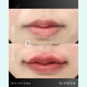 ルラ美容クリニック 札幌本院 早坂 亮哉医師の症例