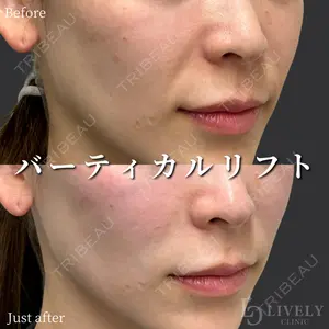 ライブリークリニック 大阪院の症例