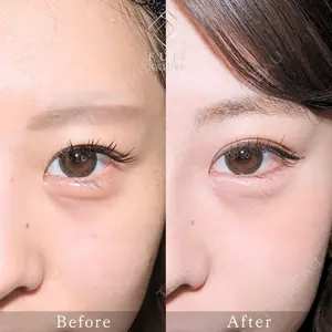 藤・ナチュレ美容クリニック 銀座院 小川 杏平医師の症例