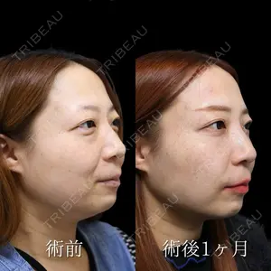 NARU Beauty Clinic 【ナルクリ】 倉津　諭医師の症例