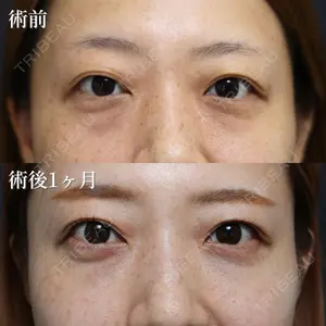 NARU Beauty Clinic 【ナルクリ】 倉津　諭医師の症例