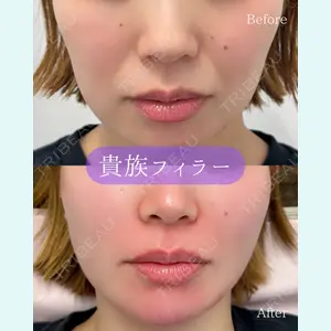 ルラ美容クリニック 郡山院の症例