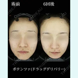 HAAB BEAUTY CLINIC 名古屋院の症例