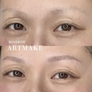 MEMOTO CLINIC 名古屋 宮崎久留明医師の症例