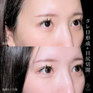 藤・ナチュレ美容クリニック 銀座院 小川 杏平医師の症例