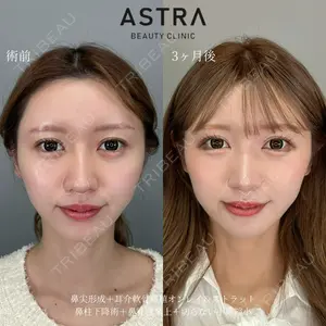 ASTRA BEAUTY CLINIC 塩満 惠子医師の症例