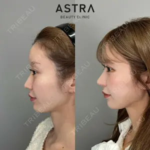 ASTRA BEAUTY CLINIC 塩満 惠子医師の症例