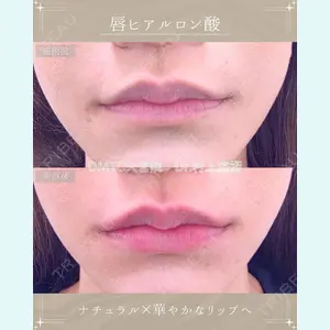 症例