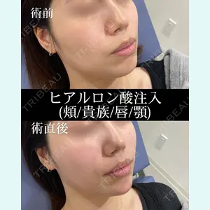 HAAB×DREAM BEAUTY CLINIC 大阪梅田院 錦 実奈医師の症例