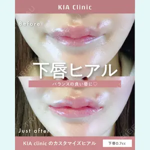 KIA CLINIC 心斎橋院 雲山　盛秀医師の症例