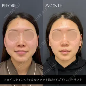 RIVER CLINIC（リバークリニック）の症例