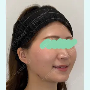 Olivia Clinic 山﨑 香名医師の症例