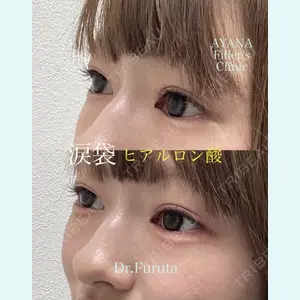 AYANAフィラーズクリニック 渋谷院 古田 晃医師の症例