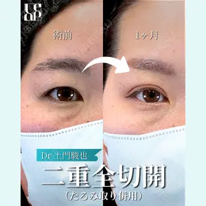 Leap beauty clinic 土門 駿也医師の症例