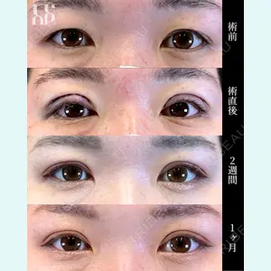 Leap beauty clinic 土門 駿也医師の症例