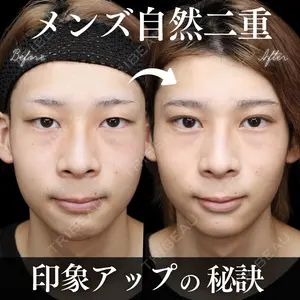 症例