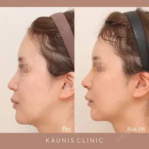 KAUNIS CLINIC（カウニスクリニック）の症例