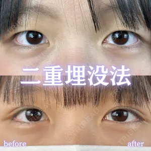 ルラ美容クリニック 新宿院 陶 美梨医師の症例