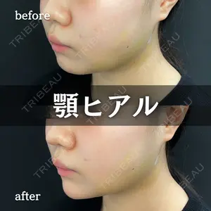 ルラ美容クリニック 新宿院 陶 美梨医師の症例