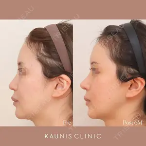 KAUNIS CLINIC（カウニスクリニック）の症例