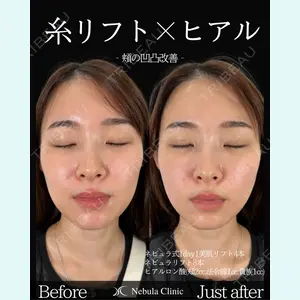 ネビュラクリニック 東京錦糸町院 岩切 琢磨医師の症例