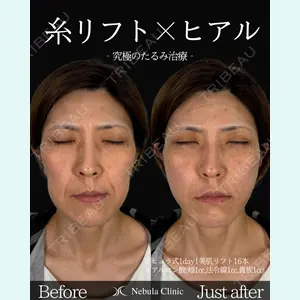 ネビュラクリニック 東京錦糸町院 岩切 琢磨医師の症例