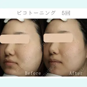 LUNA BEAUTY CLINIC 池袋駅前院の症例