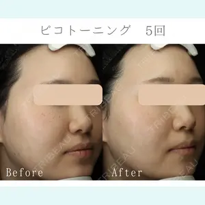 LUNA BEAUTY CLINIC 池袋駅前院の症例