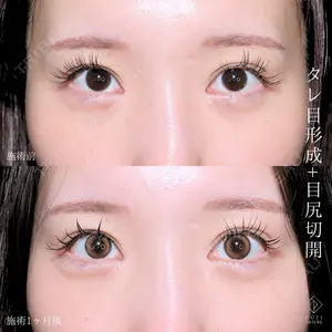 藤・ナチュレ美容クリニック 銀座院 小川 杏平医師の症例