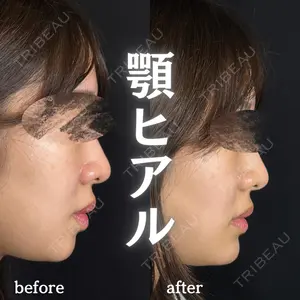 ルラ美容クリニック 新宿院 陶 美梨医師の症例