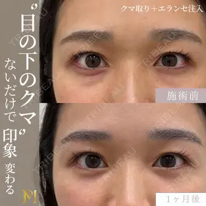 症例