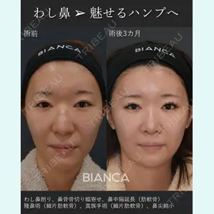 症例