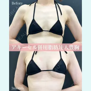 ルラ美容クリニック 名古屋本院 山本 美佳医師の症例