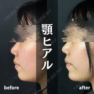 ルラ美容クリニック 新宿院 陶 美梨医師の症例