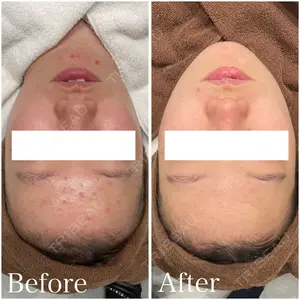 日本ウェルネス再生クリニックの症例